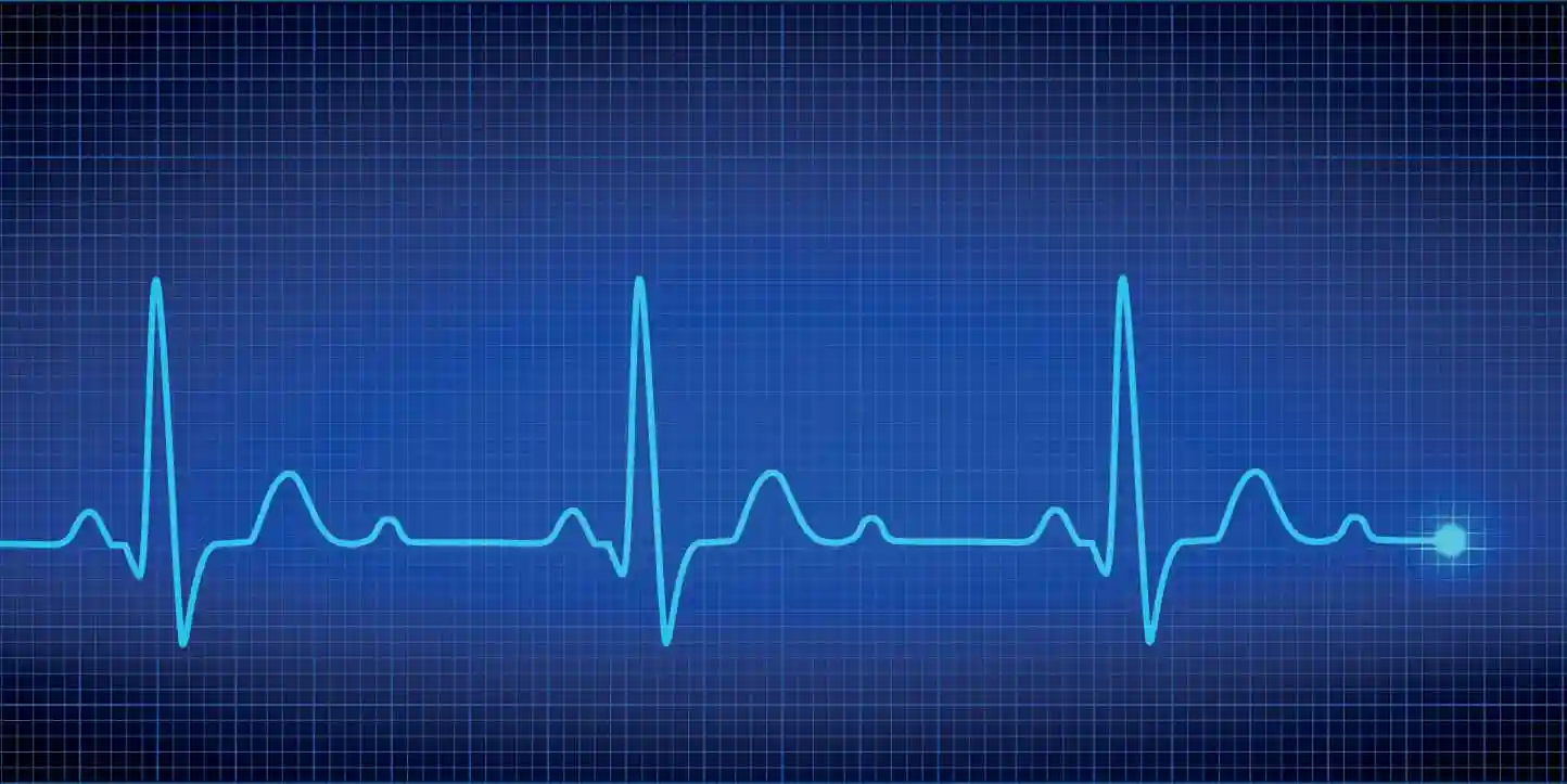 Electrocardiogramas en Bogotá