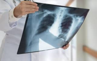 Radiografía de Tórax en Bogotá