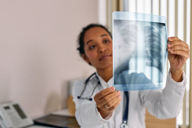 Miocardiopatía Diabética