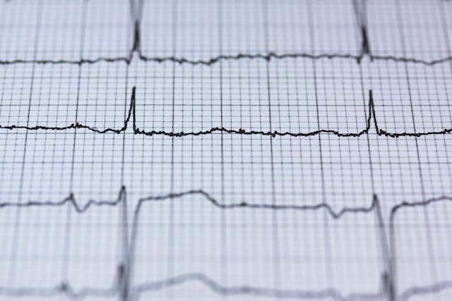 Ecocardiografía: Importancia en el Diagnóstico Cardíaco